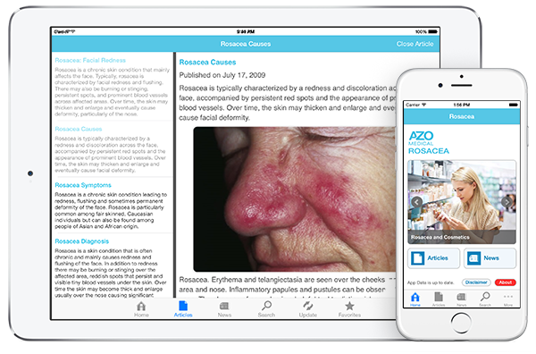 Rosacea by AZoMedical App screenshots