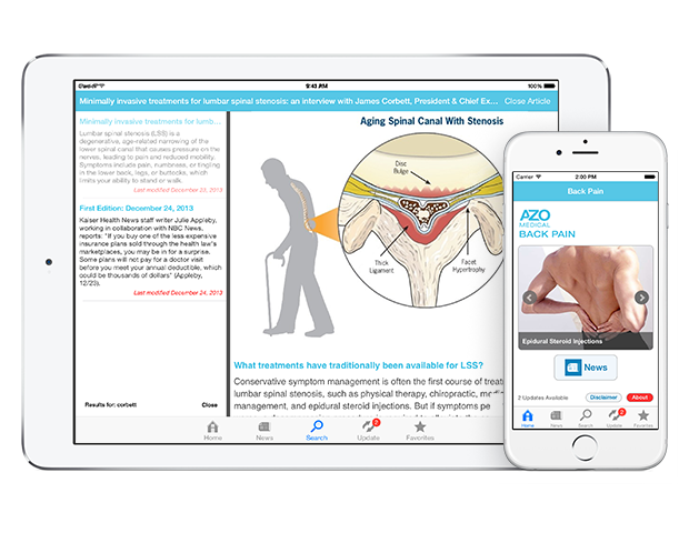 Back Pain by AZoMedical