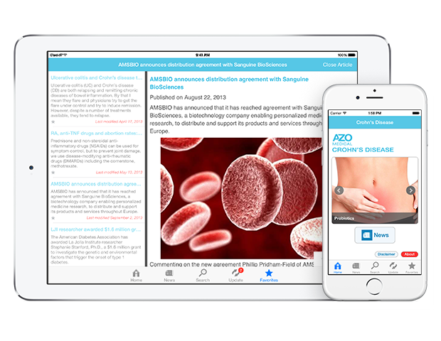Crohn's Disease by AZoMedical