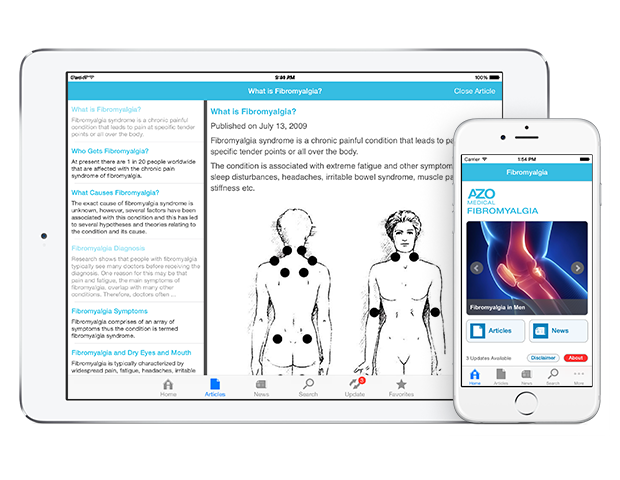 Fibromyalgia by AZoMedical