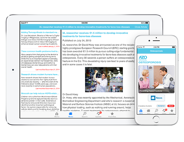 Osteoporosis by AZoMedical