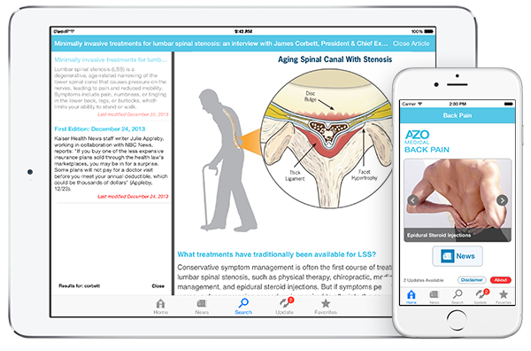 Back Pain by AZoMedical App screenshots
